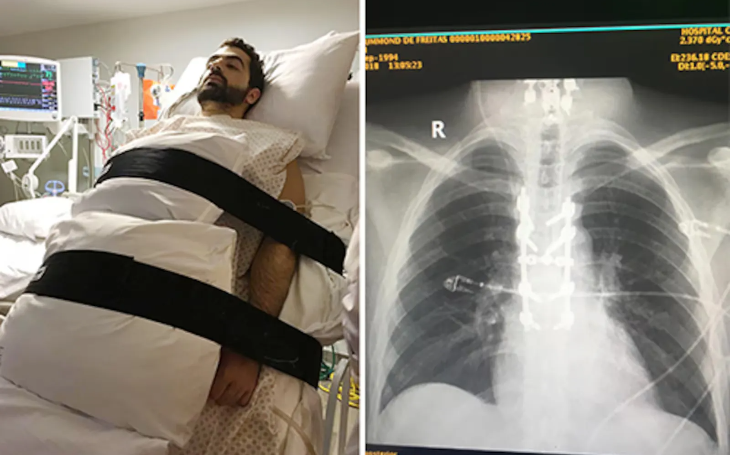 Anvisa libera pesquisa clínica da polilaminina, substância que pode regenerar lesão medular
