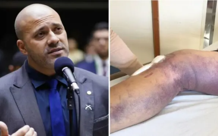 Moraes autoriza Daniel Silveira a fazer tratamento fora da prisão