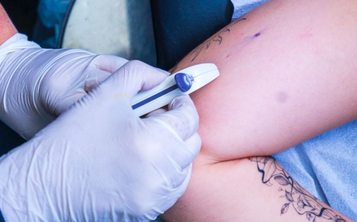 Paraíba vai ofertar contraceptivo subdérmico e capacita médicos e enfermeiros da Atenção Básica